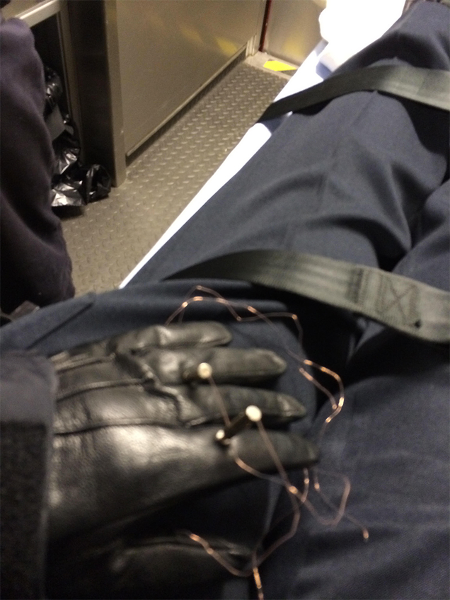 Image of Ross’s tased hand